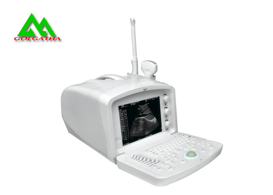 Chine Scanner humain d'ultrason d'équipement médical d'ultrason de Digital avec l'affichage d'affichage à cristaux liquides fournisseur